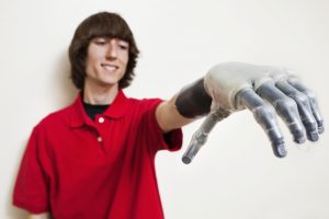 TheMerkle prosthetic Hand