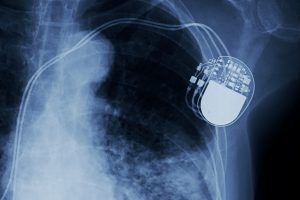 TheMerkle Pacemaker Vulnerabilities